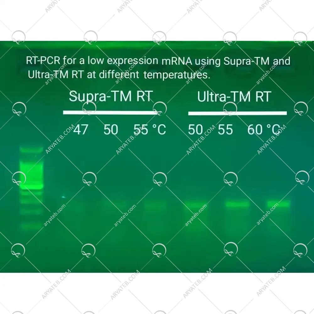 کیت سنتز cDNA اولترا