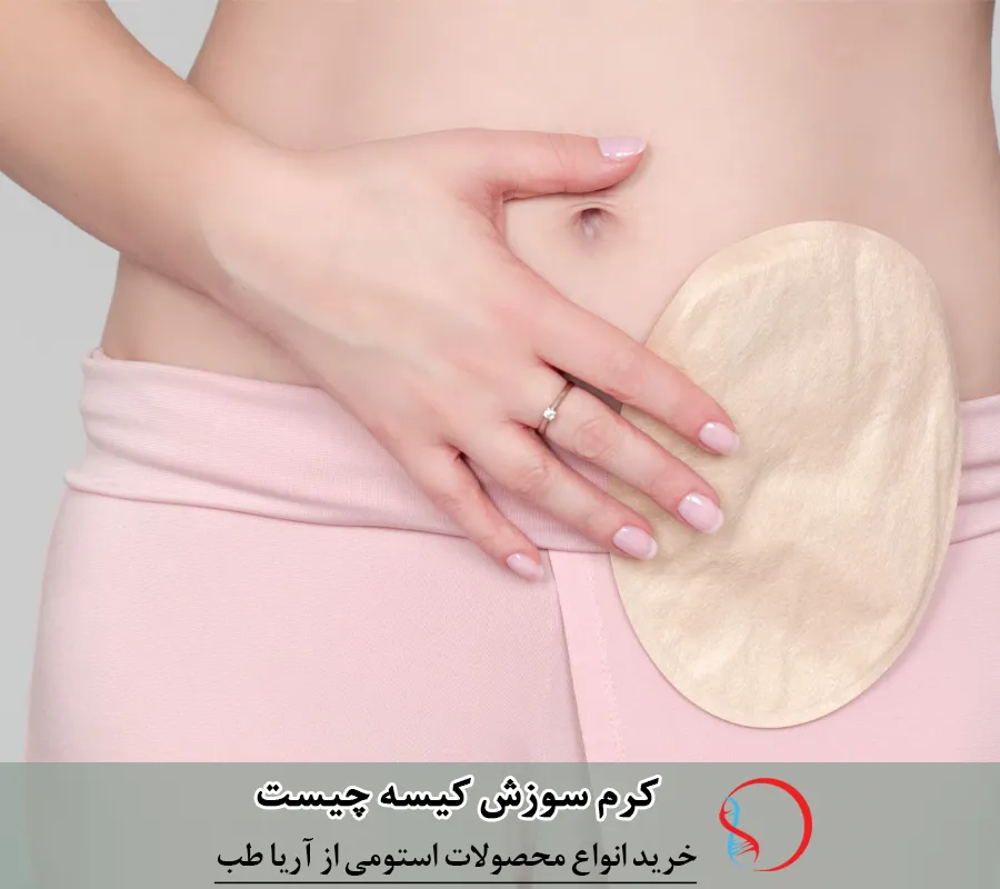 کرم سوزش کیسه چیست