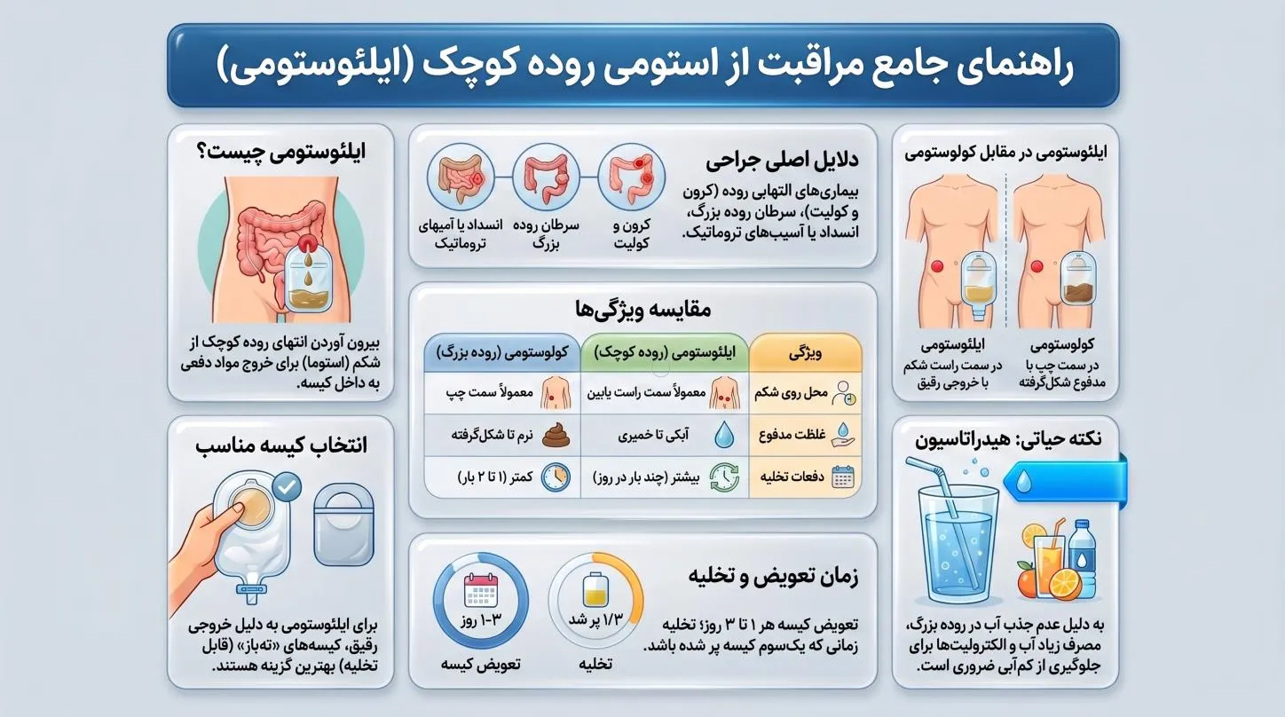 استومی روده کوچک