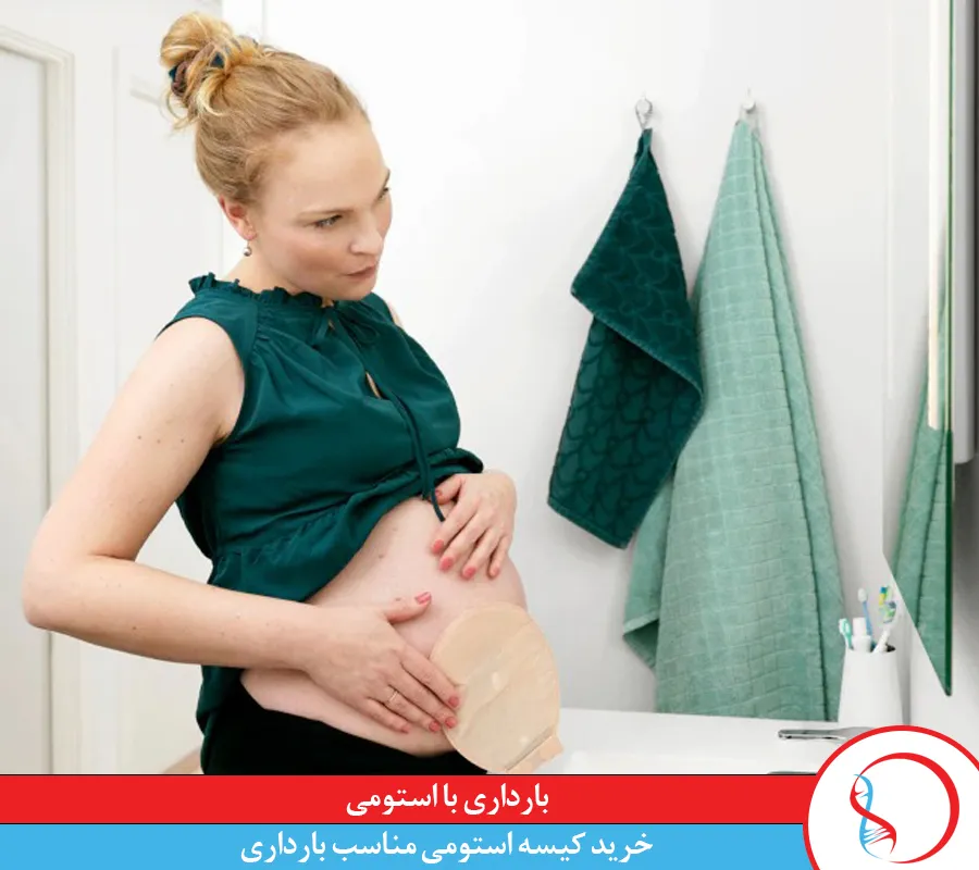 بارداری با استومی