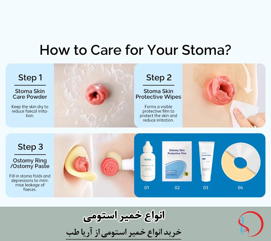 نحوه استفاده از خمیر استومی