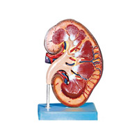 مولاژ کلیه