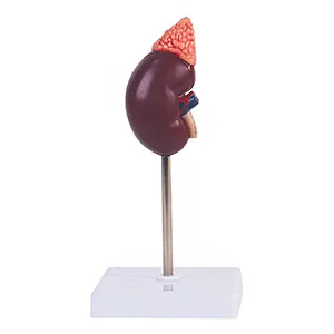 مولاژ کلیه و غده فوق کلیه
